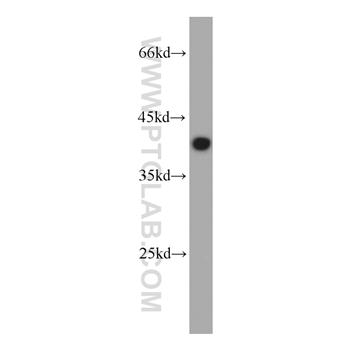 DNAJB2 Rabbit Polyclonal Antibody (10838-1-AP)