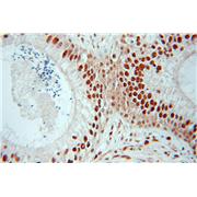 CTBP1 Rabbit Polyclonal Antibody (10972-1-AP)