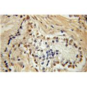 HEY2 Rabbit Polyclonal Antibody (10597-1-AP)