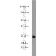 IL18 Rabbit Polyclonal Antibody (10663-1-AP)