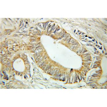 RP6-213H19.1 Rabbit Polyclonal Antibody (10847-1-AP)