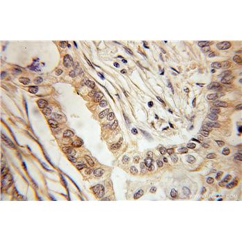 KLRC1 Rabbit Polyclonal Antibody (10935-1-AP)