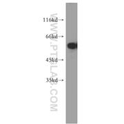 TXNRD1 Rabbit Polyclonal Antibody (11117-1-AP)