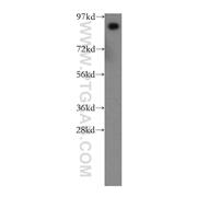 PROX1 Rabbit Polyclonal Antibody (11067-2-AP)
