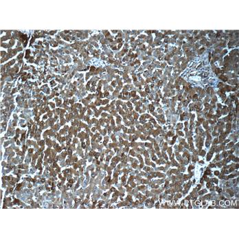 FTL Rabbit Polyclonal Antibody (10727-1-AP)