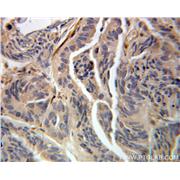 UBE2G2 Rabbit Polyclonal Antibody (10722-1-AP)