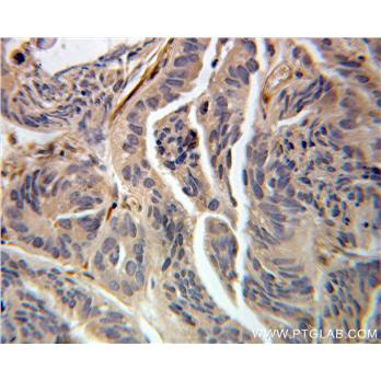 UBE2G2 Rabbit Polyclonal Antibody (10722-1-AP)