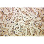 GSPT1 Rabbit Polyclonal Antibody (10763-1-AP)