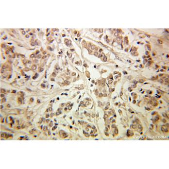 GSPT1 Rabbit Polyclonal Antibody (10763-1-AP)