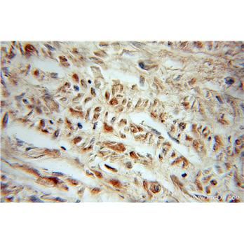 LOC729991 Rabbit Polyclonal Antibody (10931-1-AP)