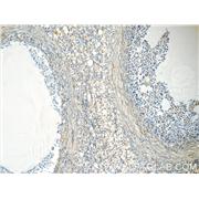 EIF2B2 Rabbit Polyclonal Antibody (11034-1-AP)