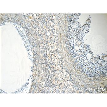 EIF2B2 Rabbit Polyclonal Antibody (11034-1-AP)