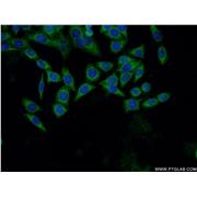 DHPS Rabbit Polyclonal Antibody (11184-1-AP)