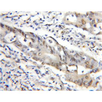 MEPCE Rabbit Polyclonal Antibody (11526-1-AP)
