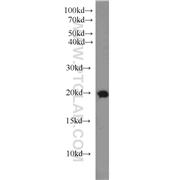 RAB18 Rabbit Polyclonal Antibody (11304-1-AP)