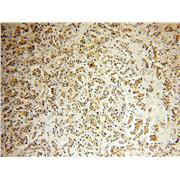 CSNK1E Rabbit Polyclonal Antibody (11230-1-AP)