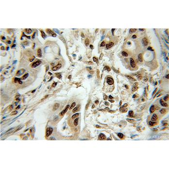 OGFR Rabbit Polyclonal Antibody (11177-1-AP)