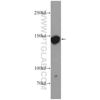 PRUNE2 Rabbit Polyclonal Antibody (11458-1-AP)