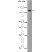 EXT2 Rabbit Polyclonal Antibody (11348-1-AP)