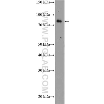 EXT2 Rabbit Polyclonal Antibody (11348-1-AP)