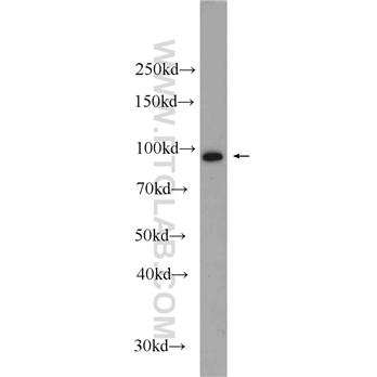 ASCC2 Rabbit Polyclonal Antibody (11529-1-AP)