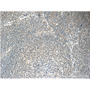FBXL18 Rabbit Polyclonal Antibody (11556-1-AP)