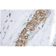 APLN Rabbit Polyclonal Antibody (11497-1-AP)