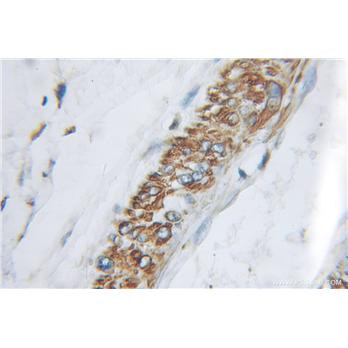 APLN Rabbit Polyclonal Antibody (11497-1-AP)