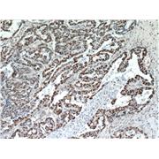 HDGF Rabbit Polyclonal Antibody (11344-1-AP)