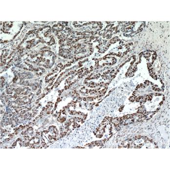HDGF Rabbit Polyclonal Antibody (11344-1-AP)