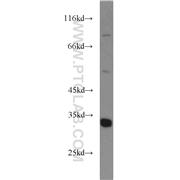 ECH1 Rabbit Polyclonal Antibody (11385-1-AP)