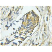 PTPN1 Rabbit Polyclonal Antibody (11334-1-AP)