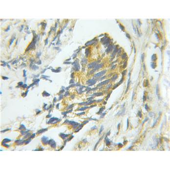 PTPN1 Rabbit Polyclonal Antibody (11334-1-AP)