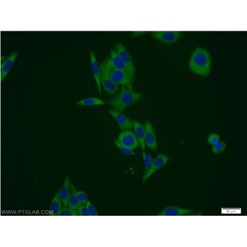 PSMD12 Rabbit Polyclonal Antibody (11412-1-AP)