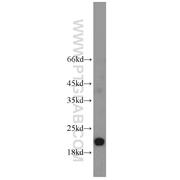PTP4A1 Rabbit Polyclonal Antibody (11508-1-AP)