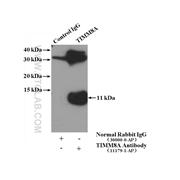 TIMM8A Rabbit Polyclonal Antibody (11179-1-AP)
