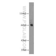 MOXD1 Rabbit Polyclonal Antibody (11545-1-AP)