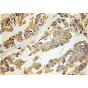 HARS2 Rabbit Polyclonal Antibody (11301-1-AP)