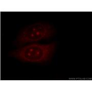 MALT1 Rabbit Polyclonal Antibody (11660-1-AP)