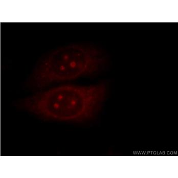 MALT1 Rabbit Polyclonal Antibody (11660-1-AP)