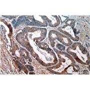 PDPN Rabbit Polyclonal Antibody (11629-1-AP)