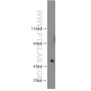 LILRA2 Rabbit Polyclonal Antibody (11461-1-AP)