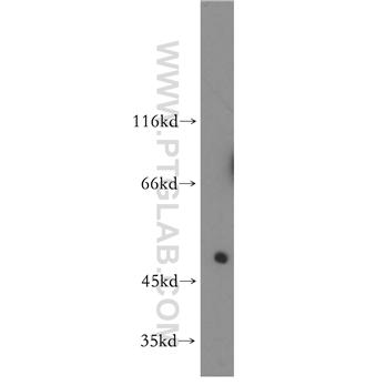 LILRA2 Rabbit Polyclonal Antibody (11461-1-AP)
