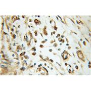NMNAT1 Rabbit Polyclonal Antibody (11399-1-AP)
