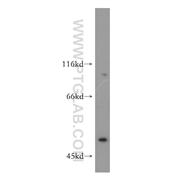 DCTN2 Rabbit Polyclonal Antibody (11361-1-AP)