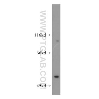 DCTN2 Rabbit Polyclonal Antibody (11361-1-AP)