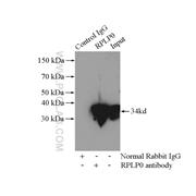RPLP0 Rabbit Polyclonal Antibody (11290-2-AP)