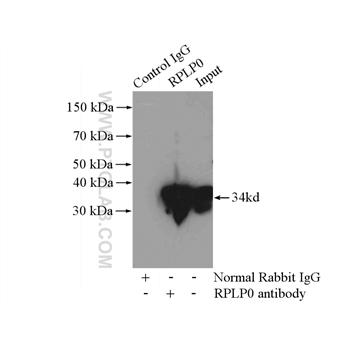 RPLP0 Rabbit Polyclonal Antibody (11290-2-AP)