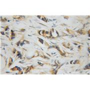 UBE2D3 Rabbit Polyclonal Antibody (11677-1-AP)