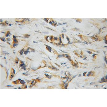 UBE2D3 Rabbit Polyclonal Antibody (11677-1-AP)